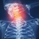 편타한의원 이미지