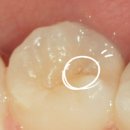 이(e)-밝은치과의원 이미지