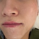 주정차45 | [전주스킨플래닝] 임산부왁싱 전문점에서 3세대 스킨플래닝 후기 전주 왁싱파크