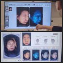 아주고운피부과의원 | [서대문] 광화문흑자제거 잘하는 피부과 테라스의원에서 왕건이 제거한 리얼 후기