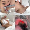 용테라피 | 마곡피부관리 온더스킨 쿨링 진정 수분관리 산소테라피 추천 후기