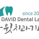 알프스치과기공소 네이버블로그