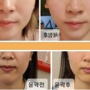뷰티라인 이미지