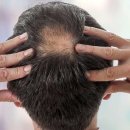 그로우모모 두피 탈모 케어센터 이미지