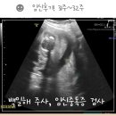 대성요양병원 | 노산초산맘의 [임신후기 8Momth 31주~ 32주]