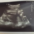 예나산부인과의원 | [17W 1D] 예나산부인과에서 2차 기형아 검사 (피 검사)