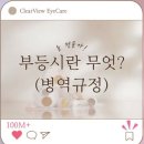 부동시 관련 안경 조제.가공 사례/부동시/부등시/검안잘하는 안경원/어지럽지않은 안경/반월당 안경원 이미지