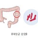 대장균 감염(Escherichia coli (E. coli) infection) 이미지