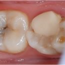 자연미소치과 이미지