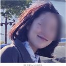인덕원 좋은꿈한의원 | 인덕원에서 흑자제거 완료! 꾸준히 피부 관리해야하는 이유