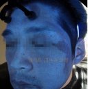 셀렉트피부과의원 네이버블로그