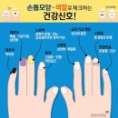 ■02월19일★수요일■손톱모양색상으로체크하는건강신호 이미지