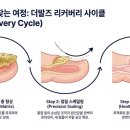 더발즈
