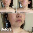 바디닥터달서 이미지