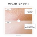차스킨일산