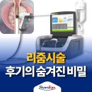 서울탑비뇨의학과의원 | 리줌시술 후기 많은 사람들이 이 치료를 찾는 이유 신논현 비뇨의학과의원에서는