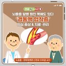 뇌졸중 발병 원인 목에도 있다 ‘경동맥 협착증’ 의심 증상 &amp; 치료‧관리 이미지