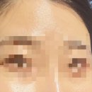 스킨 올 빛
