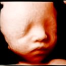 선인펜션 | [30대 임신 27-29주차 28주 입체초음파 시기 선택검사] 입체초음파 실물과 싱크로율 어떨까? 끝나가는...