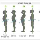 바른자세교정 이미지