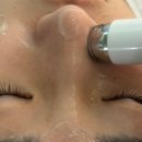 리프레쉬독 | 면목동피부관리 바나나부띠끄 30대 백설공주케어 내돈내산 레전드후기