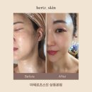 세븐일레븐부천라일락마을점 | 부천피부관리 데콜테 맛집 더헤르츠스킨 상동본점 찐 후기