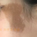 셀렉트피부과의원 이미지