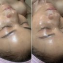 청아한에스떼 | 여름철 피부, 열감은 편안하게 수분은 촉촉하게 : 바이오폭스 메디프레스 크라이오 크림