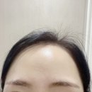 (주)휴셀 | 피부면역충전소 휴셀 nk세포 트러블진정크림 리얼후기