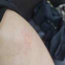 진례의원 네이버블로그