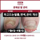 베어수