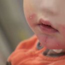 청담엔케이피부과의원 이미지