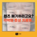 렌즈 폐기하라고요? 각막염 증상 원인 치료받고 회복중인 후기