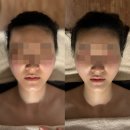 약손명가 에스테딕 남양주호평점 | 남양주피부관리 / 남양주 웨딩관리, 약손명가 남양주 호평점 동안얼굴관리 내돈내산 후기