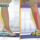 테이핑 및 마사지 이미지