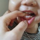 삼성바른아이치과 네이버블로그