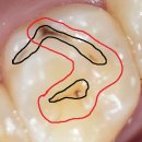 선 치과기공소 이미지