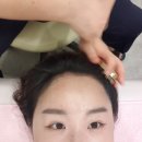 눈이부시게 에스테틱 이미지