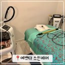 은평구 에스테틱 예쁘다스킨케어에서 E-테라피로 등관리받은 후기