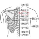 뜸의 비방책 1 이미지