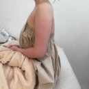 신기부영3차@ | [경산 피부관리]‘윤나는 에스테틱’ 티리온X 리프팅 솔직 후기 팔뚝살 티리온 예신관리