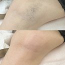 리본왁싱 경산점 이미지