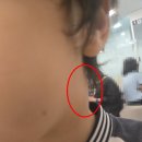 더맑은이비인후과의원 네이버블로그