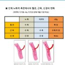 힐스템 테라피 이미지