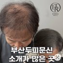 에테르노 | 부산두피문신 정수리 고민 에테르노에서 상담받은 후기