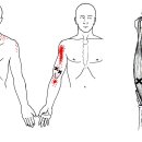 상완이두근 트리거포인트와 설명 이미지
