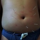 동생한의원 이미지