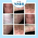 홍운한의원 네이버블로그