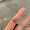 독서당정형외과의원 네이버블로그
