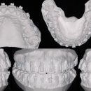 정DENTAL 이미지